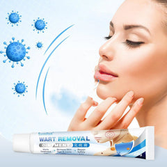 Sumifun 20G G Wart Cream, Wart Flat Corn Skin care lotion, Flat Wart On The Face