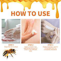 Bee Poison Kraft Moss Cream Repair Hands And Feet Red And Itchy Moisturizing