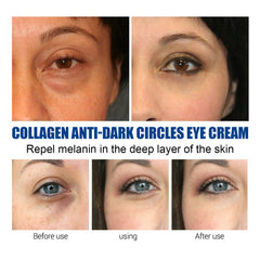 Dark Circles Remove Cream - Best under Eye Cream for Dark Circles
