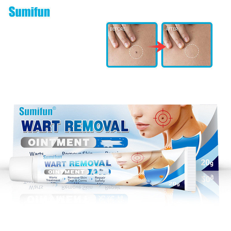 Sumifun 20G G Wart Cream, Wart Flat Corn Skin care lotion, Flat Wart On The Face