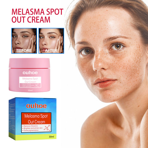 Buy Blemish Cream, Whitening Skin Reduce Melanin Melasma Stains And Hydrating Cream online at Fashionner