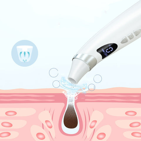 Electric Visual Blackhead Suction Instrument Household Cleansing Pore Cleaner For Skin Equipment Skin Care Tool - Fashionner