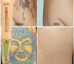 Tattoo Removal Cream