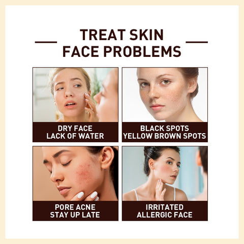 Rice Anti Wrinkle Essence, Repairs Skin Moisturizes Firms Whitens Essence