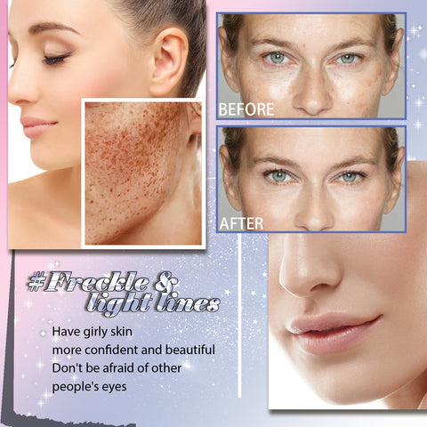 Freckle Removing Anti-aging Essence, Facial Firming Anti-wrinkle Lightening Melasma Stain Nourishing Skin Essence