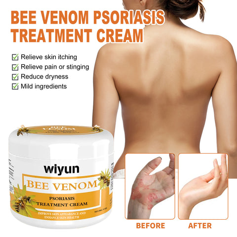 Crème Réparatrice Mousse Anti-Miel Rouge Démangeaisons Hydratante Mains et Pieds