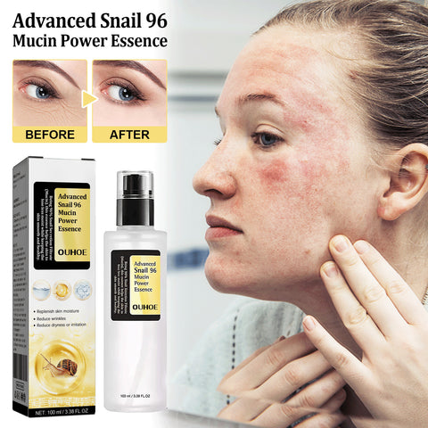 Sérum Réparateur Intensif à la Bave d'Escargot 96% 100ml (3.38 fl.oz), Hydratant Visage au Filtrage de Sécrétion d'Escargot pour Peaux Ternies et Rides Fines, Soin Coréen