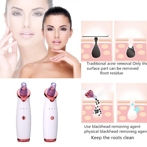 Instrument Dissolvant de Points Noirs, Aspirateur Anti-Acné, Nettoyant Facial, Outil de Soin de la Peau, Nettoyant de Pores en Profondeur