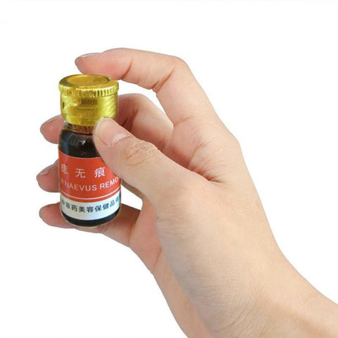 Mole Removal Cream