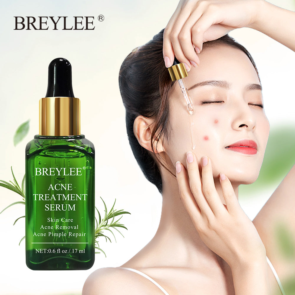 BREYLEE Acne Treatment Face Serum Mask Anti Acne Pimple Scar Remover Moisturizing Whitening Skin Care Facial Essence Cream 17ml - Fashionner