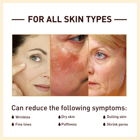 Rice Anti Wrinkle Essence, Repairs Skin Moisturizes Firms Whitens Essence