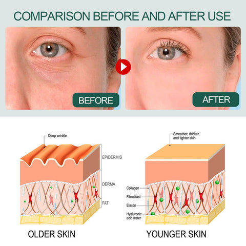Ouhoe Essence Collagen Replenishing Essence Whitening Freckle Removal Facial Essence Brightening Hydrating Moisturizing
