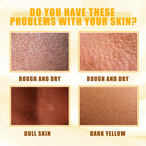 Huile exfoliante jaune, éclaircissante, hydratante, blanchissante, embellissante pour le corps et la peau