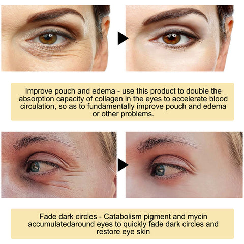 Meilleure crème pour les cernes sous les yeux - Crème anti-poches