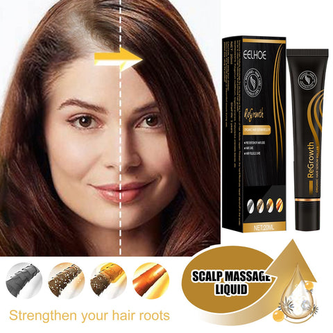 EELHOE Ball Bearing Dense Hair Essential Oil Thick Sparse Hair Bead Massage Scalp Care Fluid To Prevent The Loss Of Essential Oil - Fashionner