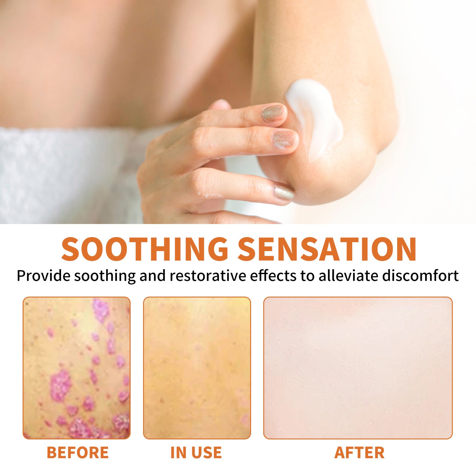 Bee Poison Kraft Moss Cream Repair Hands And Feet Red And Itchy Moisturizing