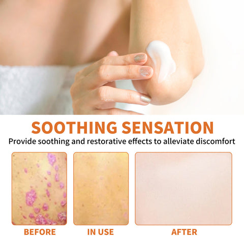 Crème Réparatrice Mousse Anti-Miel Rouge Démangeaisons Hydratante Mains et Pieds