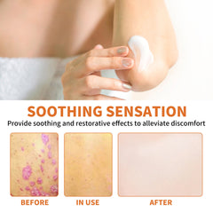 Bee Poison Kraft Moss Cream Repair Hands And Feet Red And Itchy Moisturizing