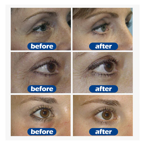 Crème anti-cernes – Meilleure crème anti-cernes pour les yeux