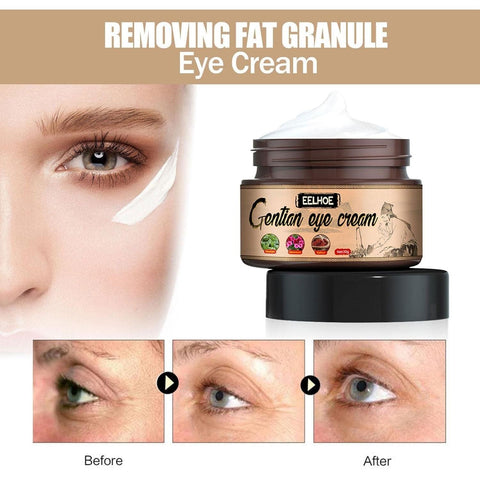Crème Douce Contour des Yeux Anti-Poches Cernes et Rides