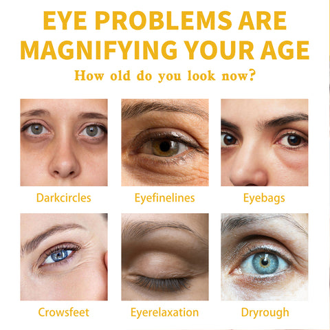 Crème Contour des Yeux à la Vitamine E, Atténue Cernes et Pattes d'Oie, Raffermit et Hydrate
