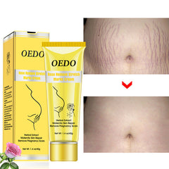 Stretch Mark Treatment Cream - Rose Stretch Mark Removal Cream Anti-Wrinkle