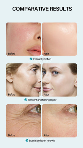 Crème Visage Anti-Rides à l'Acide Hyaluronique Hydratante Haute Hydratation Anti-Âge