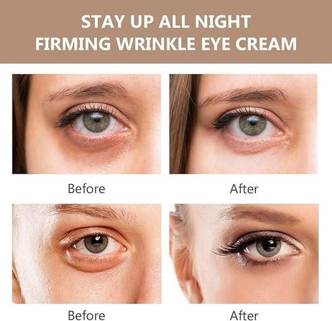 Crème Instantanée Contour des Yeux Anti-Poches Firmx 30ml