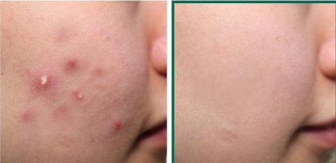 Cosmetic Facial Skin Care Licorice Root Fluoride - Fashionner