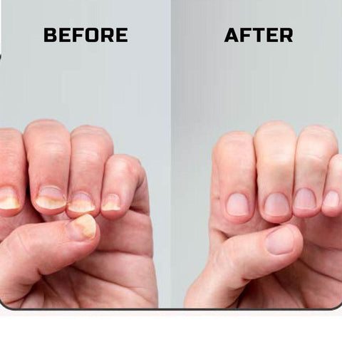 Huile Réparatrice Fortifiante & Croissance Ongles 30ml
