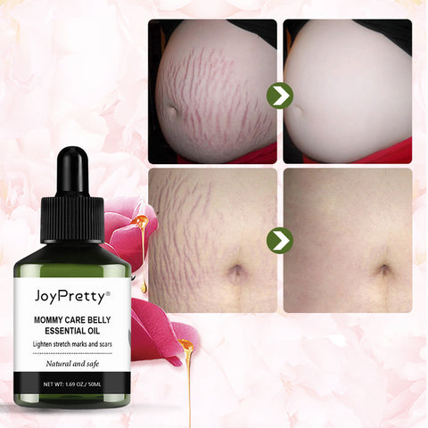Best Stretch Mark Removal Cream - Reduce Postpartum Obesity And Stretch Marks Repair Essential Oil