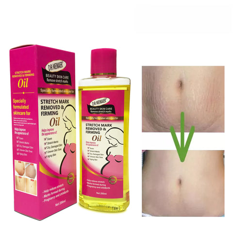 Lotion anti-vergetures - Huile apaisante hydratante multi-effets contre les vergetures