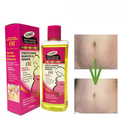 Lotion to Remove Stretch Marks - Stretch Marks Multi-Effect Moisturizing Soothing Oil