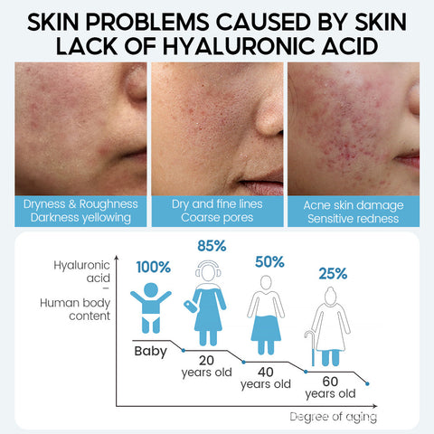 Sérum visage à l'acide hyaluronique anti-âge, rétrécit les pores, blanchissant, hydratant, crème pour le visage, soin des peaux sèches