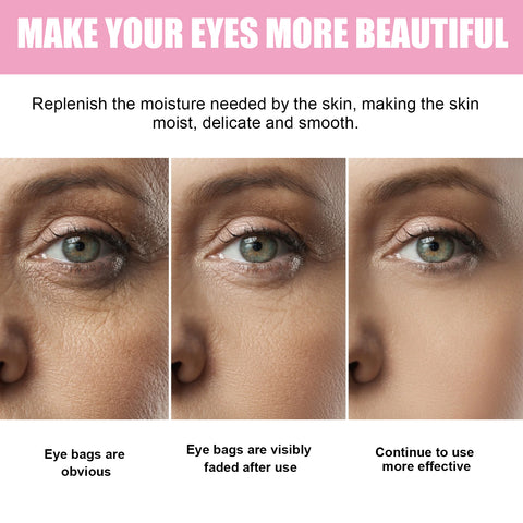 Sakura Dark Circle Eye Cream, Reduce Dark Eye Bags Around The Eyes Dull Brighten Moist Delicate Tight