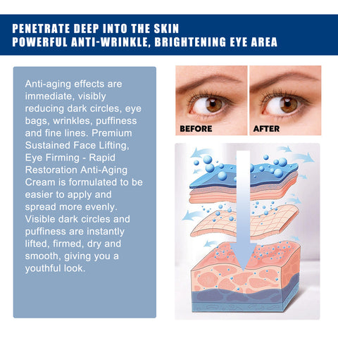 Collagen Black Circle Eye Cream, Reduces Lines Moisturizes And Repairs Skin Eye Cream