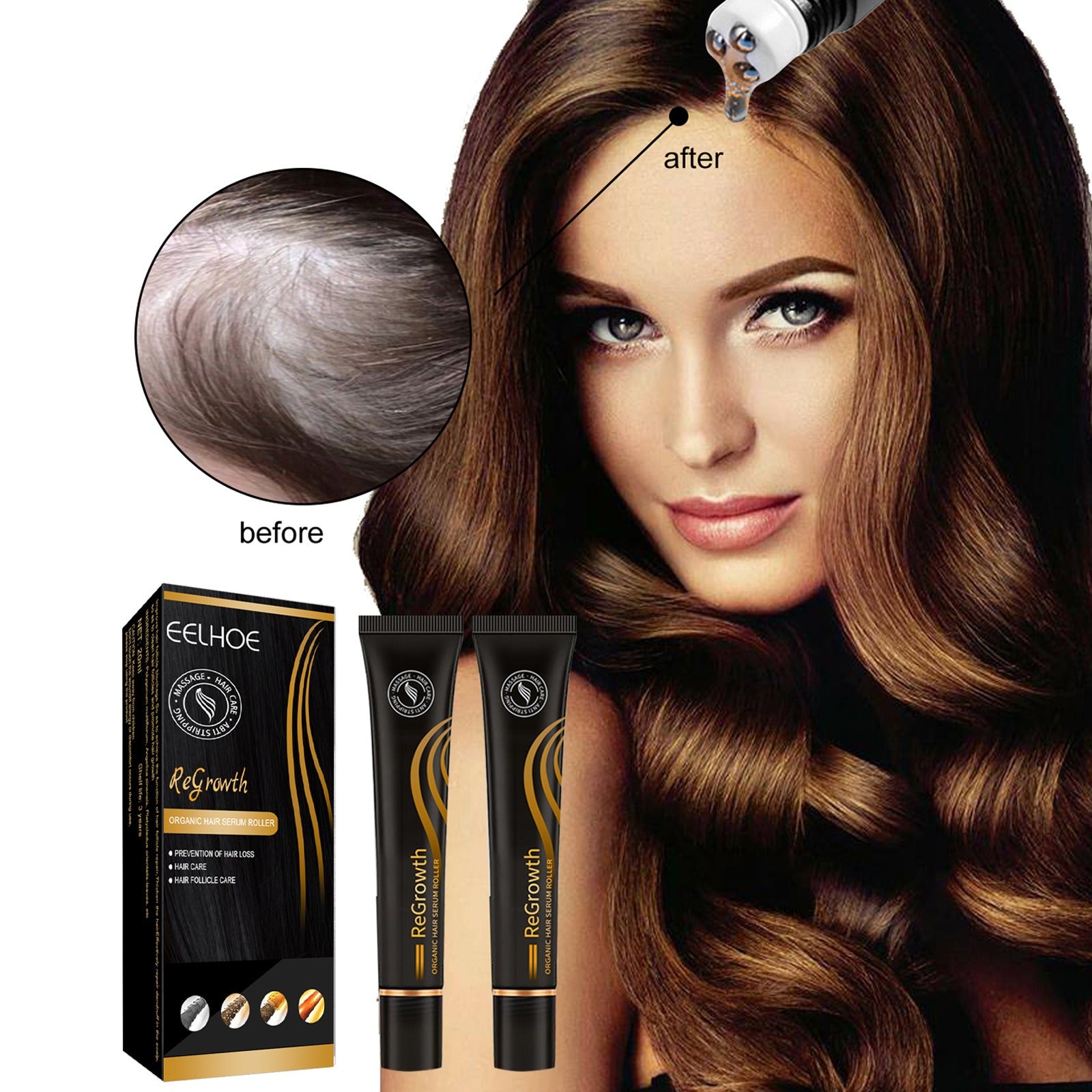 EELHOE Ball Bearing Dense Hair Essential Oil Thick Sparse Hair Bead Massage Scalp Care Fluid To Prevent The Loss Of Essential Oil - Fashionner