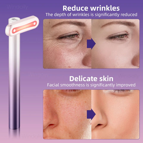 4 in 1 Facial Wand EMS Microcurrent Vibration Warm Red Light Face Lifting Machine Skin Tightening Device Neck Eye Massager Tools - Fashionner