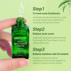 BREYLEE Acne Treatment Face Serum Mask Anti Acne Pimple Scar Remover Moisturizing Whitening Skin Care Facial Essence Cream 17ml - Fashionner