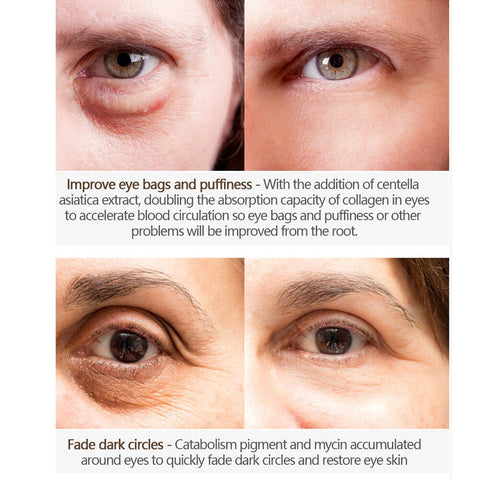1 Crème magique pour les yeux anti-cernes, anti-rides, anti-poches, réparatrice, sérum pour les yeux au crocodile, sérum au collagène peptidique, soin des yeux