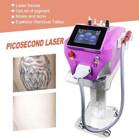 Buy Highly Welcomed Laser Tattoo Removal Picosecond Tattoo Removal Beauty Machine Laser Picosecond Laser Tattoo Removal Machine online at Fashionner.