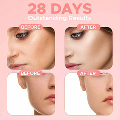 Advence Skin Care 4 In 1 FACIAL SERUM - Fashionner