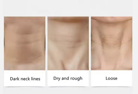 10 masques pour le cou au lait de chèvre et à l'hexapeptide, soins de la peau au collagène