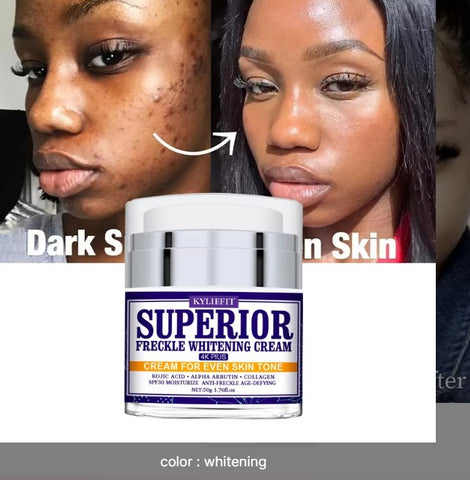 Ailke Customized in 7 Days Instant Fast Day and Night Vitamin C Whitening Face Cream for Dark Skin