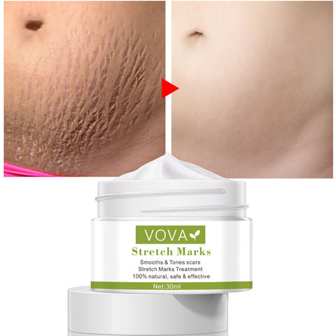Crème Anti-Vergetures