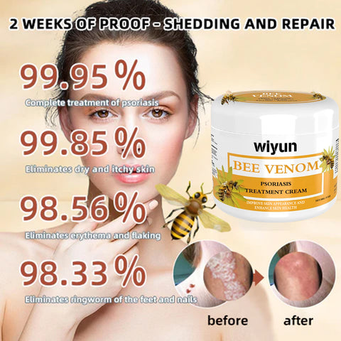 Crème Réparatrice Mousse Anti-Miel Rouge Démangeaisons Hydratante Mains et Pieds