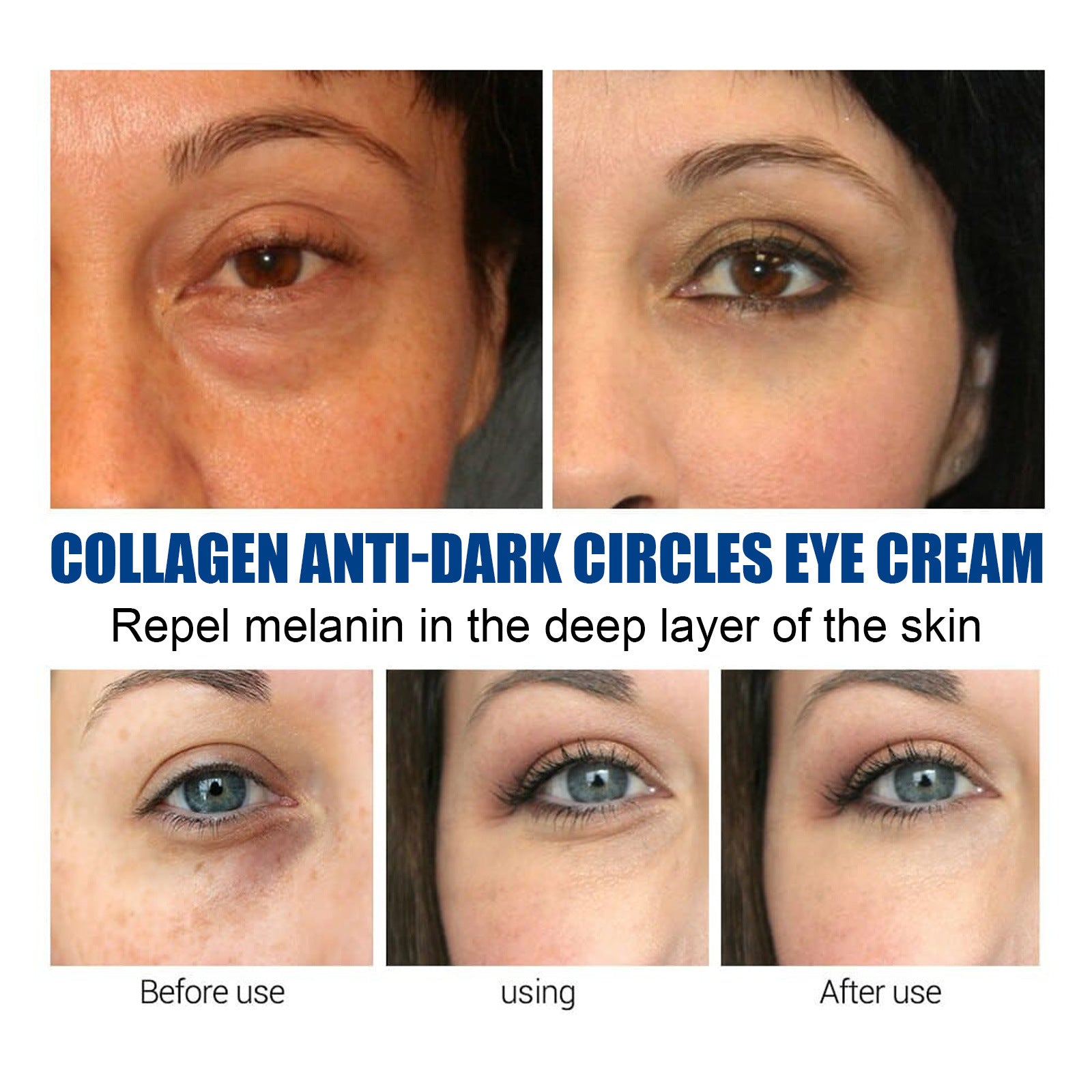 Dark Circles Remove Cream - Best under Eye Cream for Dark Circles