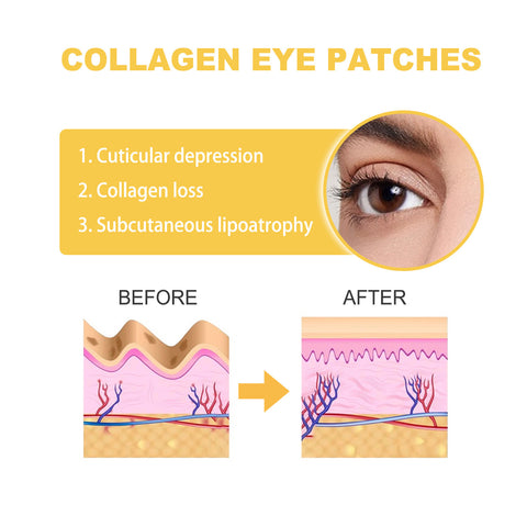 Patchs masques pour les yeux au collagène, estompent les rides et ridules, hydratants, anti-âge