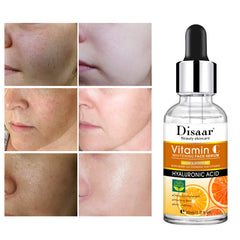 Vitamin C and Hyaluronic Acid Serum - Hyaluronic Acid Vitamin C Face Serum Whitening
