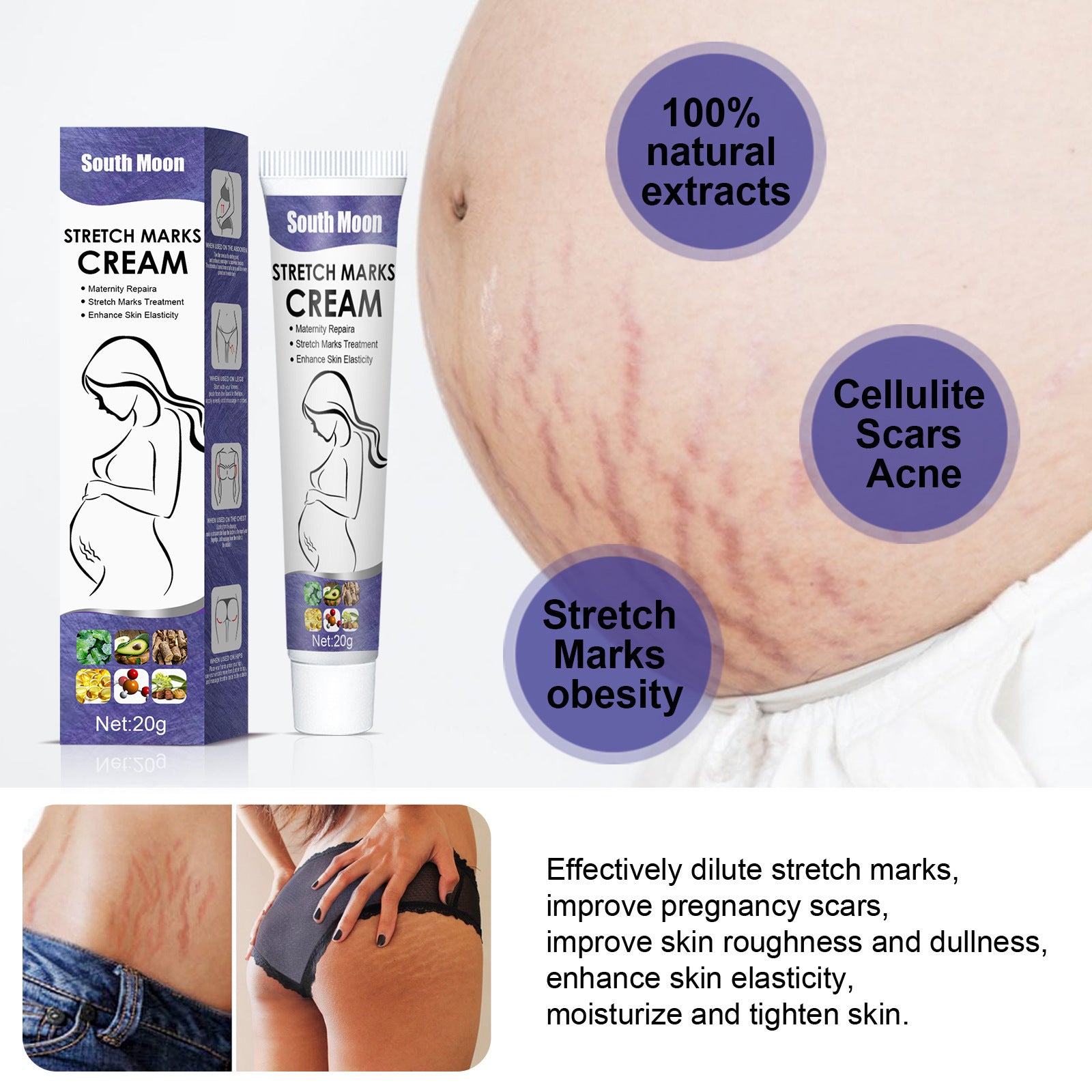 Scar Repairing Cream Skin Fade Growth Lines Obesity Stretch Marks